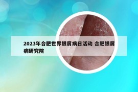 2023年合肥世界银屑病日活动 合肥银屑病研究院