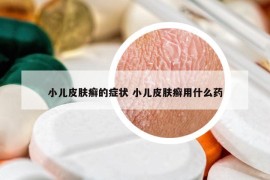 小儿皮肤癣的症状 小儿皮肤癣用什么药