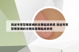 简述寻常型银屑病的主要临床表现 简述寻常型银屑病的分期及各期临床表现