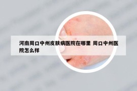 河南周口中州皮肤病医院在哪里 周口中州医院怎么样