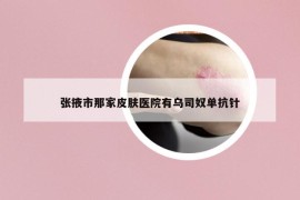 张掖市那家皮肤医院有乌司奴单抗针