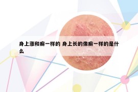 身上涨和癣一样的 身上长的像癣一样的是什么