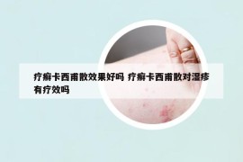 疗癣卡西甫散效果好吗 疗癣卡西甫散对湿疹有疗效吗