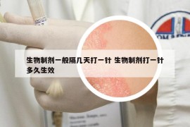 生物制剂一般隔几天打一针 生物制剂打一针多久生效