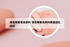 保定哪里看皮肤科 保定哪里皮肤科看痘痘比较好