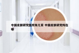 中国皮肤研究医院有几家 中国皮肤研究所在哪
