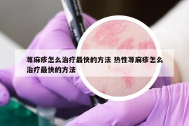 荨麻疹怎么治疗最快的方法 热性荨麻疹怎么治疗最快的方法