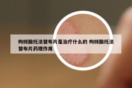 枸橼酸托法替布片是治疗什么的 枸橼酸托法替布片药理作用