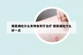 银屑病吃什么食物有利于治疗 银屑病吃什么好一点