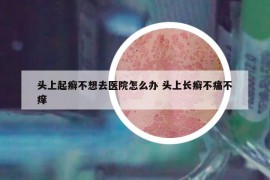 头上起癣不想去医院怎么办 头上长癣不痛不痒