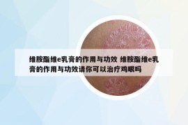 维胺酯维e乳膏的作用与功效 维胺酯维e乳膏的作用与功效请你可以治疗鸡眼吗