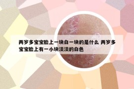 两岁多宝宝脸上一块白一块的是什么 两岁多宝宝脸上有一小块淡淡的白色