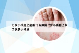 七岁小孩腿上起癣什么原因 7岁小孩腿上长了很多小红点