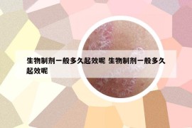 生物制剂一般多久起效呢 生物制剂一般多久起效呢