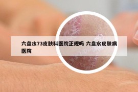 六盘水73皮肤科医院正规吗 六盘水皮肤病医院