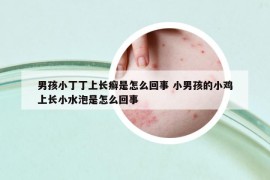 男孩小丁丁上长癣是怎么回事 小男孩的小鸡上长小水泡是怎么回事