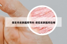 保定市皮肤医院专科 保定皮肤医院在哪