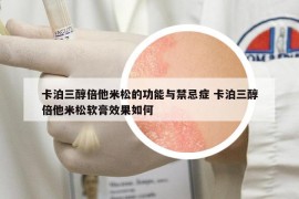 卡泊三醇倍他米松的功能与禁忌症 卡泊三醇倍他米松软膏效果如何