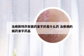 治癣新特药有国药准字的是什么药 治癣病的国药准字药品