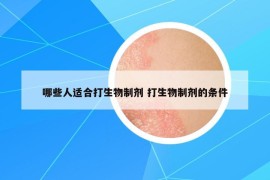 哪些人适合打生物制剂 打生物制剂的条件