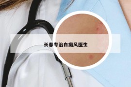 长春专治白癜风医生