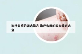 治疗头癣的四大偏方 治疗头癣的四大偏方大全