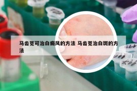 马齿苋可治白癜风的方法 马齿苋治白斑的方法