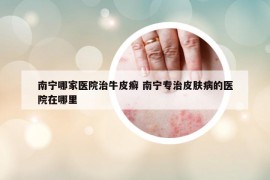 南宁哪家医院治牛皮癣 南宁专治皮肤病的医院在哪里