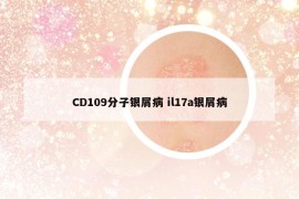 CD109分子银屑病 il17a银屑病