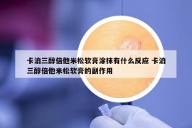 卡泊三醇倍他米松软膏涂抹有什么反应 卡泊三醇倍他米松软膏的副作用