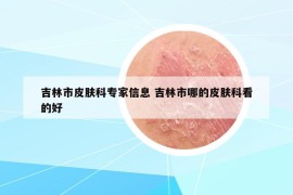 吉林市皮肤科专家信息 吉林市哪的皮肤科看的好