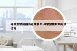 寻常型银屑病消退期多久 寻常型银屑病好转过程