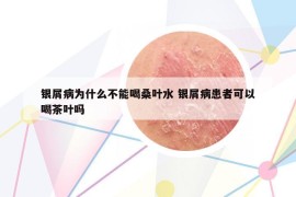 银屑病为什么不能喝桑叶水 银屑病患者可以喝茶叶吗