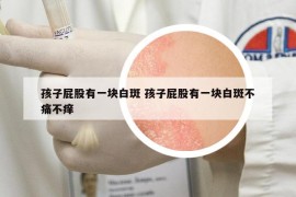 孩子屁股有一块白斑 孩子屁股有一块白斑不痛不痒