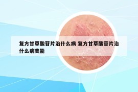 复方甘草酸苷片治什么病 复方甘草酸苷片治什么病美能