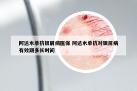 阿达木单抗银屑病医保 阿达木单抗对银屑病有效期多长时间