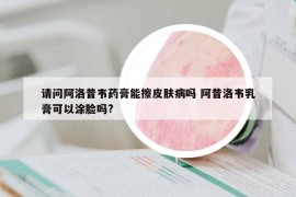 请问阿洛昔韦药膏能擦皮肤病吗 阿昔洛韦乳膏可以涂脸吗?