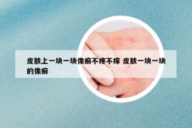 皮肤上一块一块像癣不疼不痒 皮肤一块一块的像癣