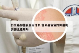 舒立嘉抑菌乳膏治什么 舒立嘉宝宝好抑菌乳膏婴儿能用吗