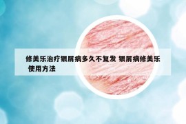 修美乐治疗银屑病多久不复发 银屑病修美乐 使用方法