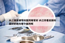 内江银屑病专科医院哪家好 内江市看皮肤科最好的地方哪个医院呢