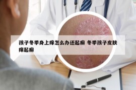 孩子冬季身上痒怎么办还起癣 冬季孩子皮肤痒起癣