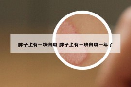 脖子上有一块白斑 脖子上有一块白斑一年了