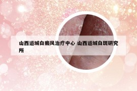 山西运城白癜风治疗中心 山西运城白斑研究所