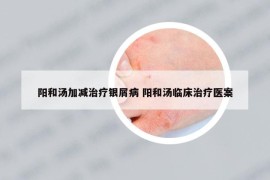 阳和汤加减治疗银屑病 阳和汤临床治疗医案