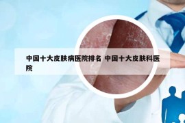 中国十大皮肤病医院排名 中国十大皮肤科医院