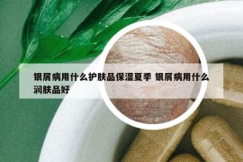 银屑病用什么护肤品保湿夏季 银屑病用什么润肤品好