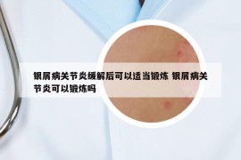 银屑病关节炎缓解后可以适当锻炼 银屑病关节炎可以锻炼吗