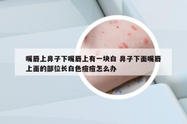 嘴唇上鼻子下嘴唇上有一块白 鼻子下面嘴唇上面的部位长白色痘痘怎么办