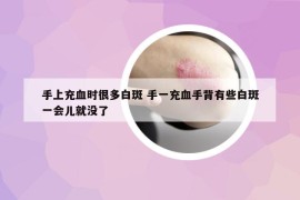 手上充血时很多白斑 手一充血手背有些白斑一会儿就没了